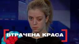 Касается каждого - Утраченная красота (Эфир 28.02.19)